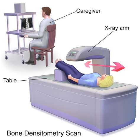 Bone Mineral Densitometry .